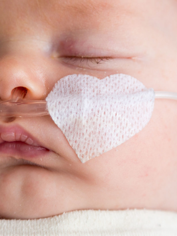 Newborn baby is getting oxygen via nasal prongs to assure oxygen saturation