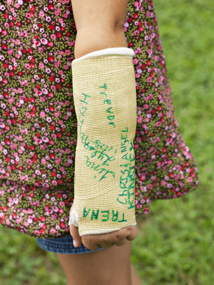 Little girl's arm wearing a cast that has been autographed by friends