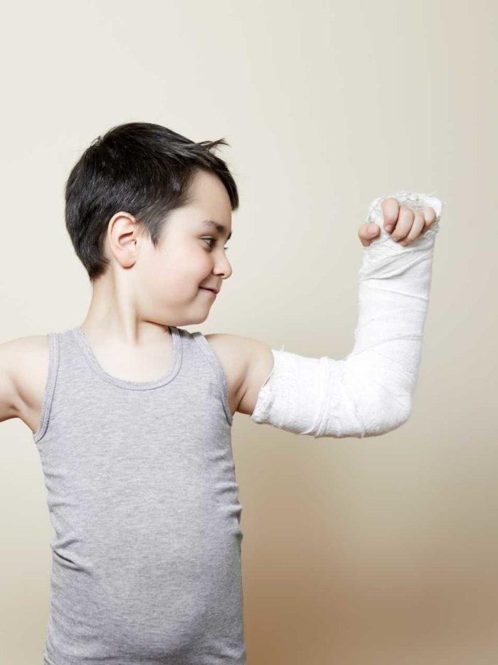Boy in cast flexing arms
