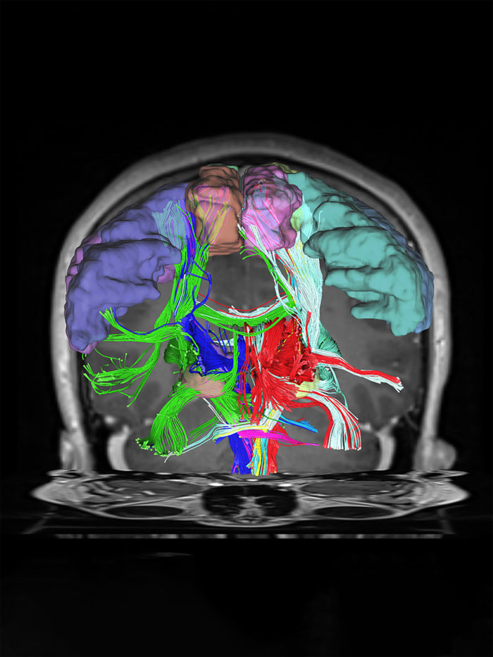 Brain mapping image depicting the inside of a brain