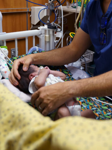 Baby in CHOC NICU with provider's hands