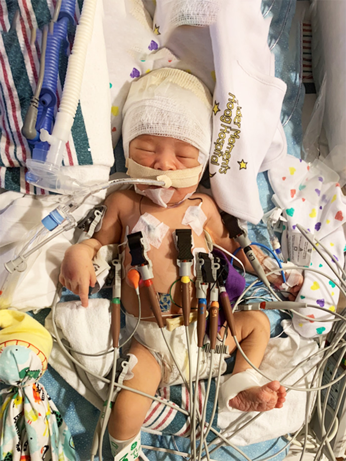 Christian LeMaster receiving treatment for neonatal seizures