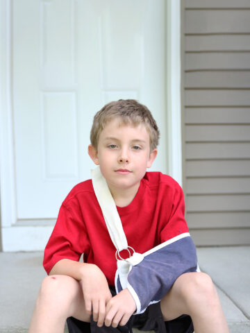 Child with arm sling sits on front step and looks into the camera