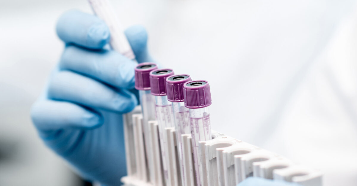 CHOC receives prestigious NIH grant to study treatment for rare