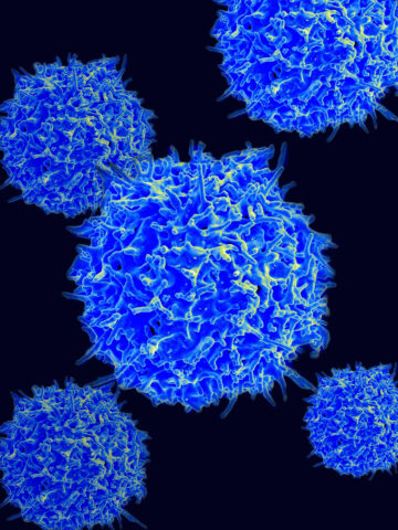 Determining the role of regulatory T cells in successful immunotherapy 