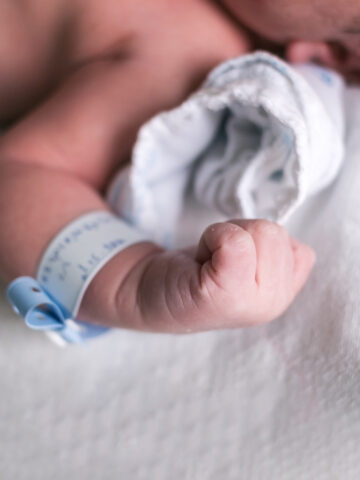 Close-up of baby's hand with a hospital bracelet - Gastroschisis - cord closure procedure