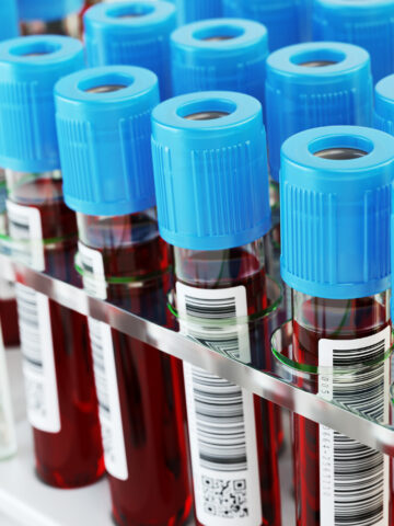 Blood vials - pediatric sepsis research study