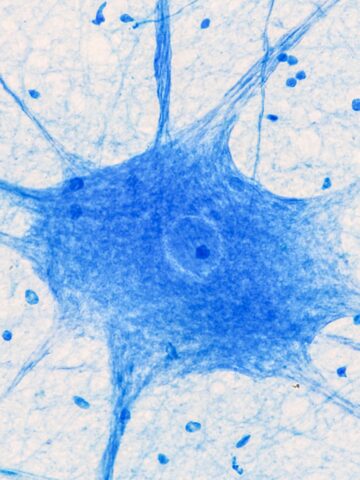 Novel bioelectronic device could advance pediatric neurologic care 