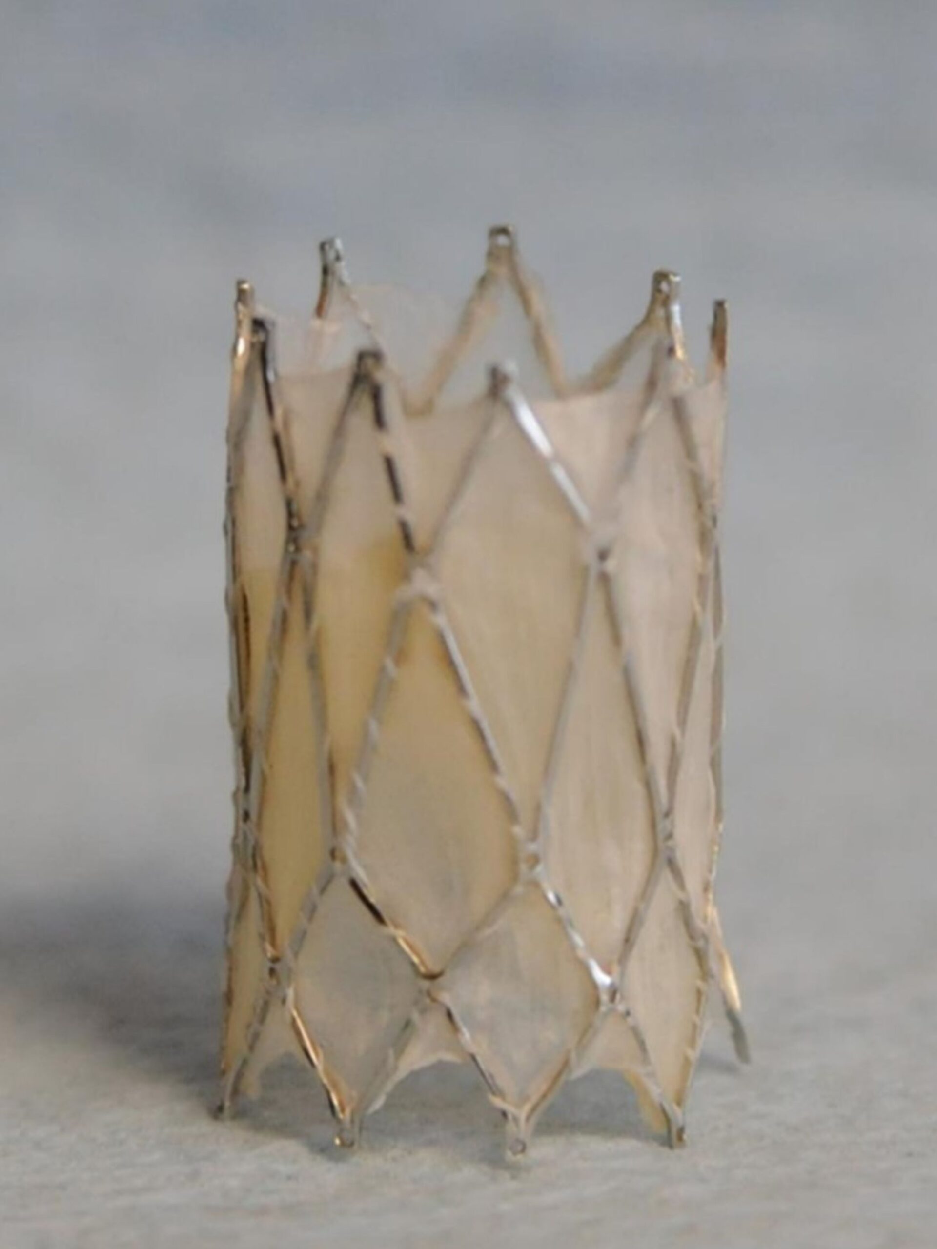 Photo of IRIS heart valve
