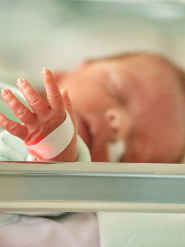 CHOC participation in multi-center quality improvement initiative seeks improved growth outcomes in NICU babies who undergo intestinal surgery