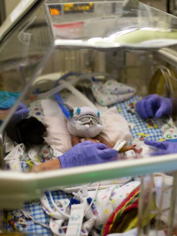 Improving safety: advancements in necrotizing enterocolitis care