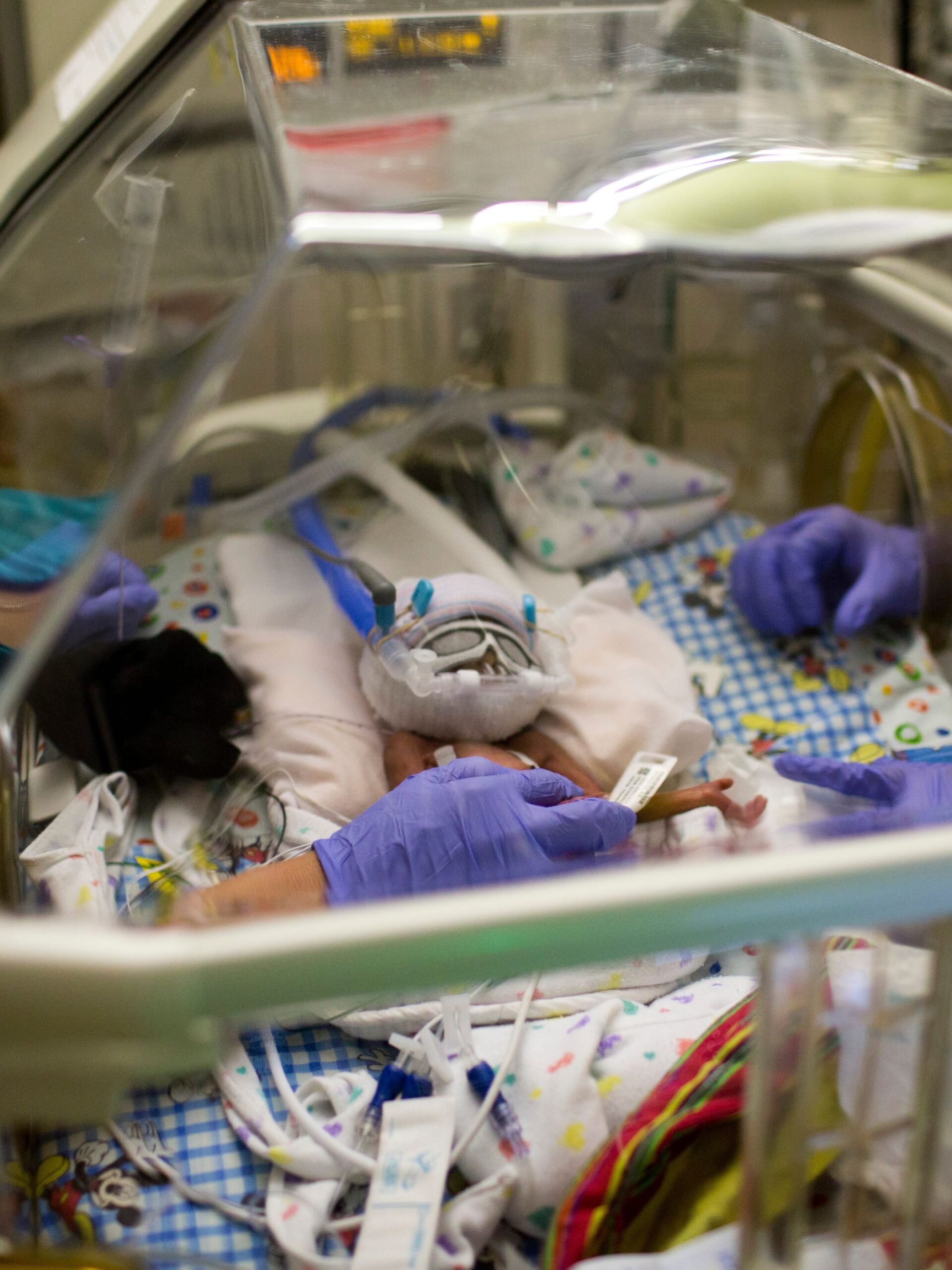 Small Baby Unit patient