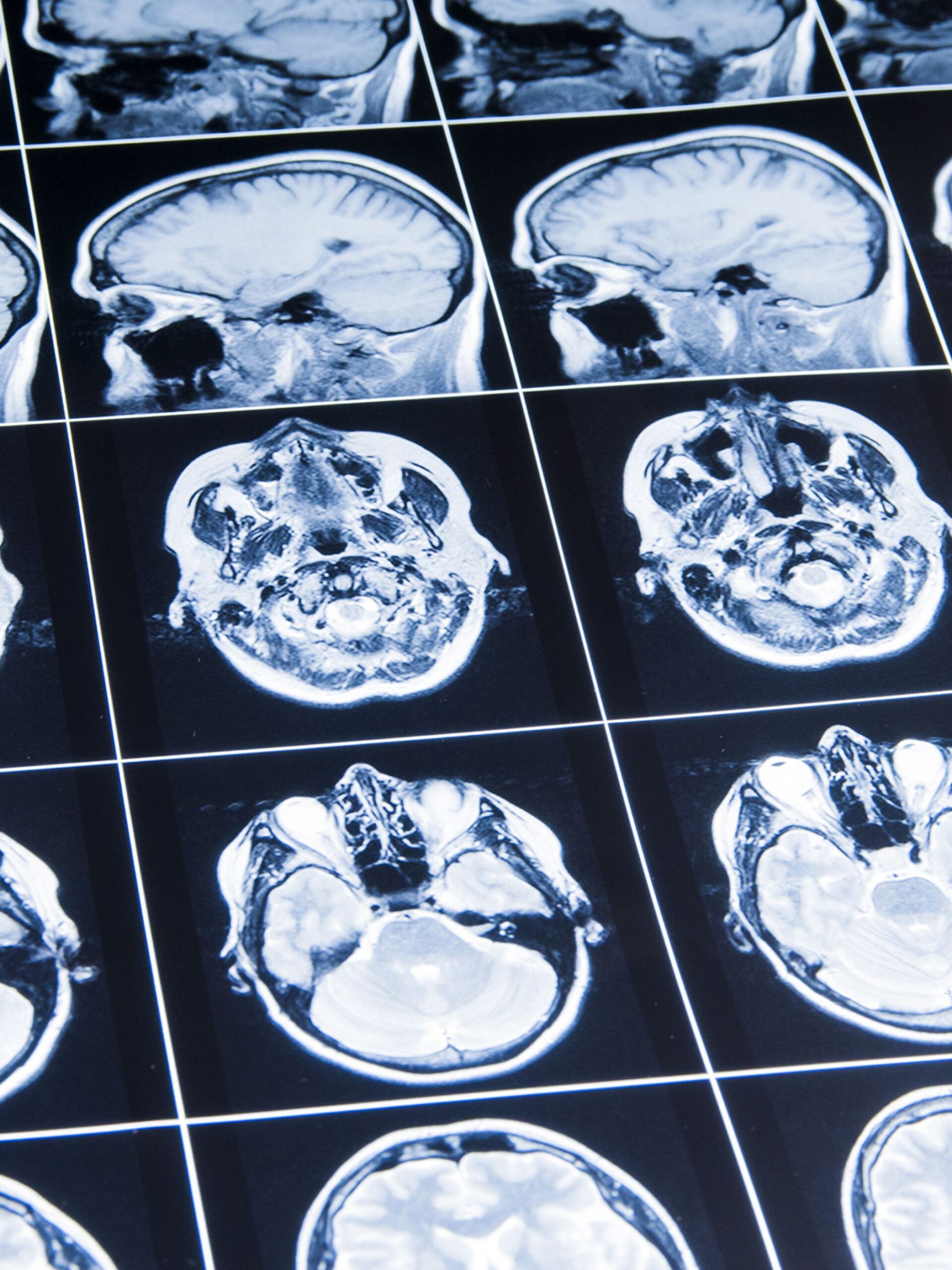 Images of brain scans