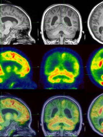 Brain mapping images