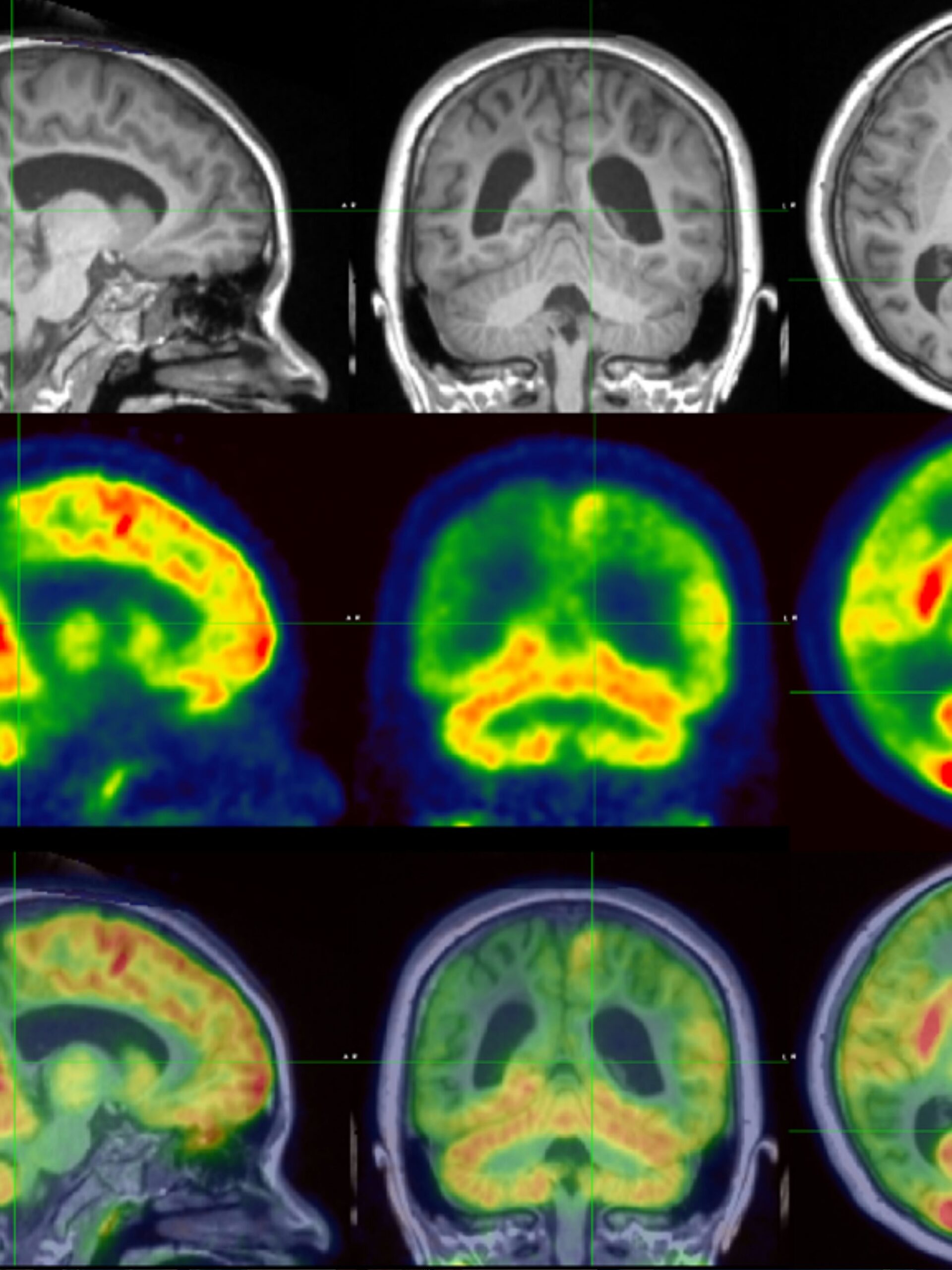Brain mapping images