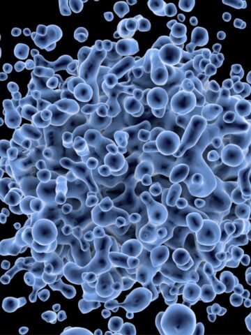 Envisioning the future of precision oncology by reframing cancer relapse
