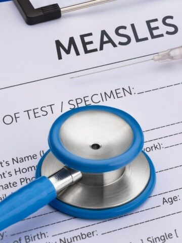 Confronting the potential for a return of a rare measles sequela